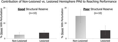 Non-Invasive Brain Stimulation to Enhance Upper Limb Motor Practice Poststroke: A Model for Selection of Cortical Site